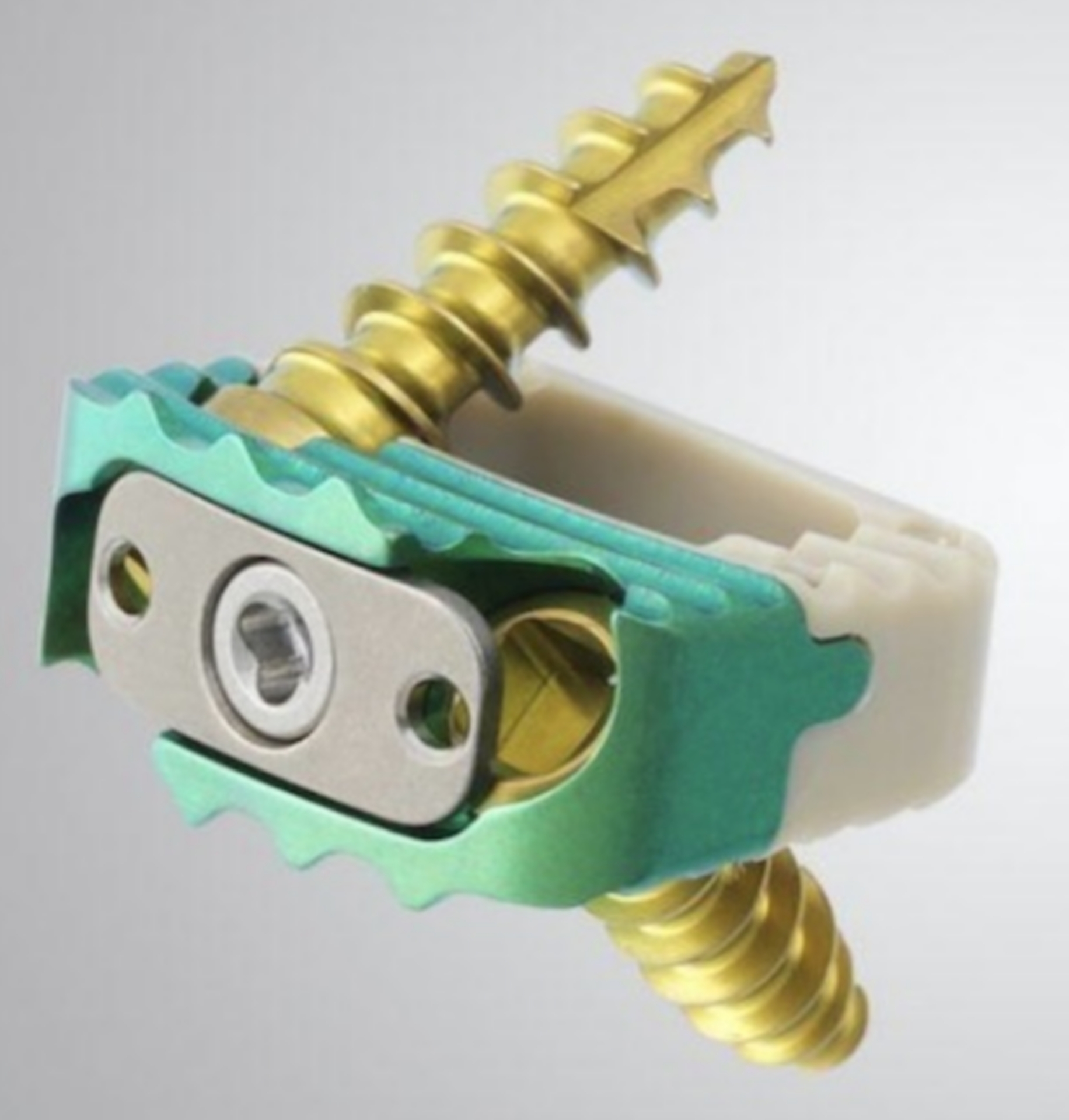 Шийний кейдж з гвинтами Medical Concept 7x15.5x13 mm